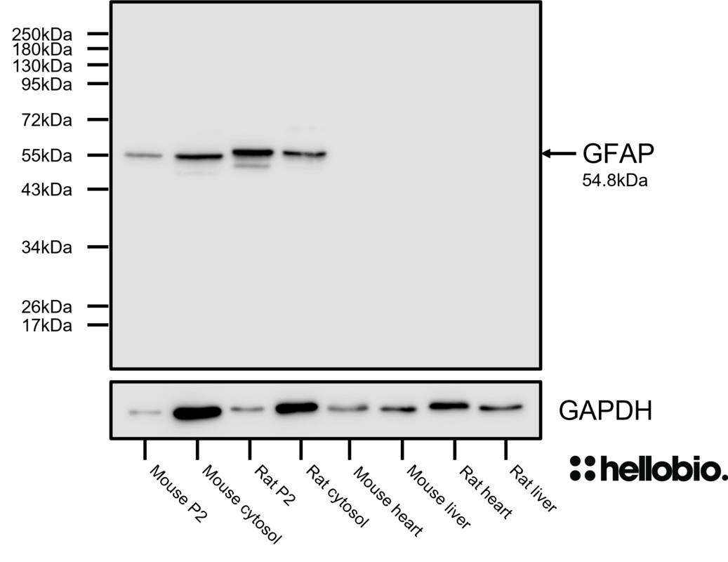 Figure 7. GFAP expression in various tissue lysates and preparations.
