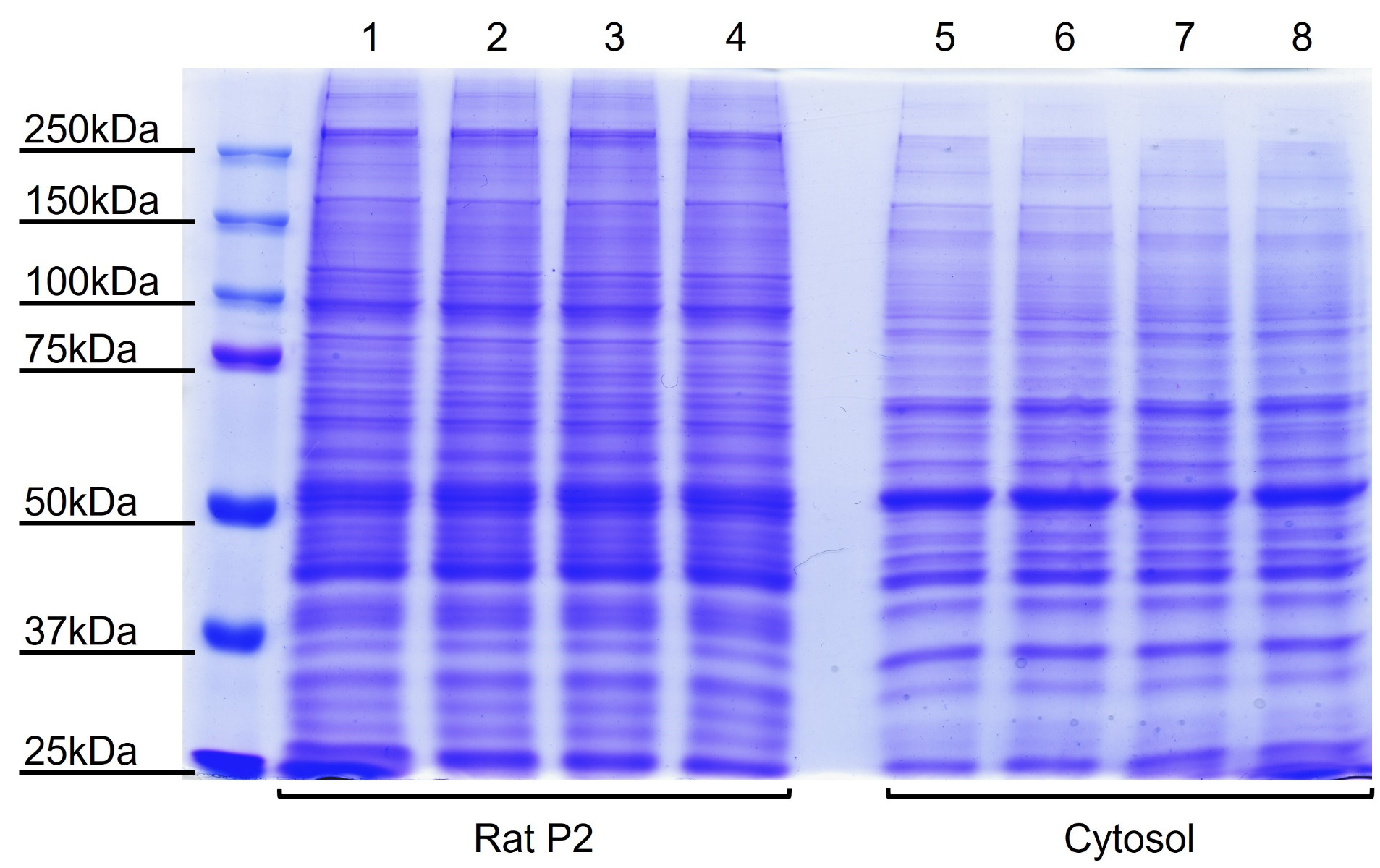 Figure1. Protein expression in rat brain P2 membrane and cytosol fractions.