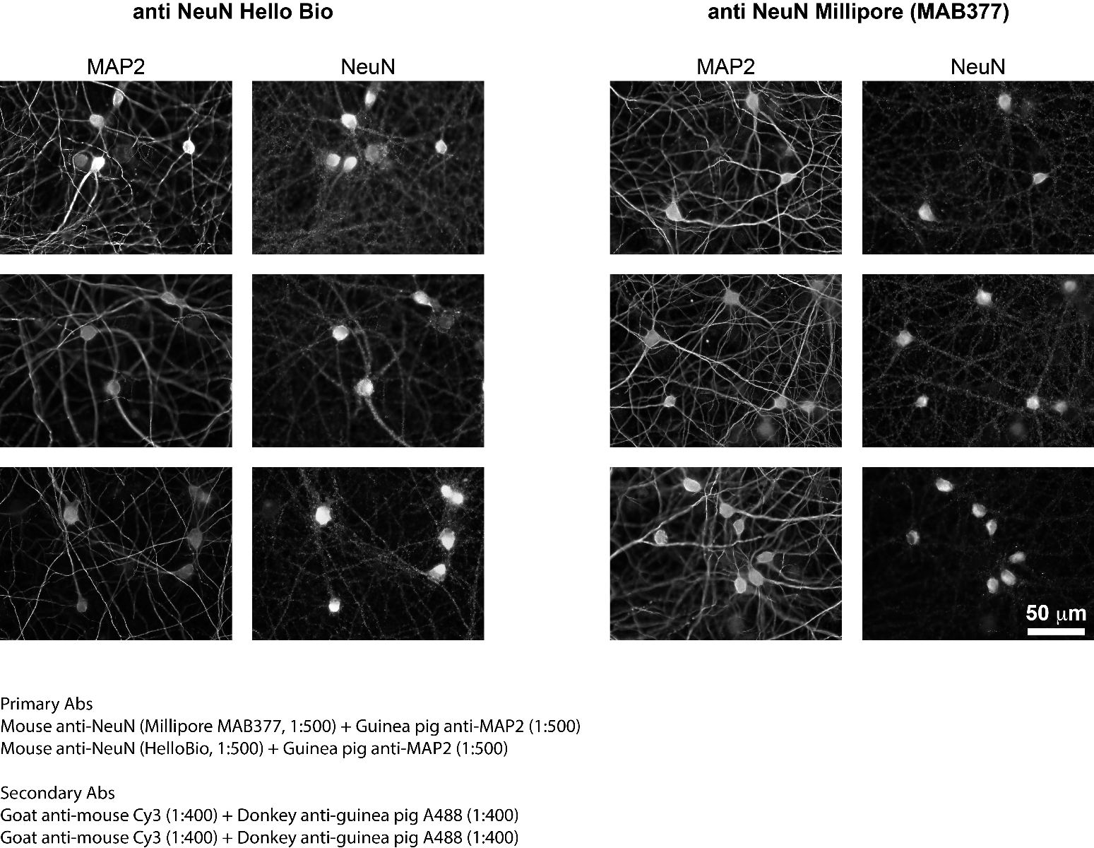 Immunostainings comparing NeuN staining in mouse brain slices