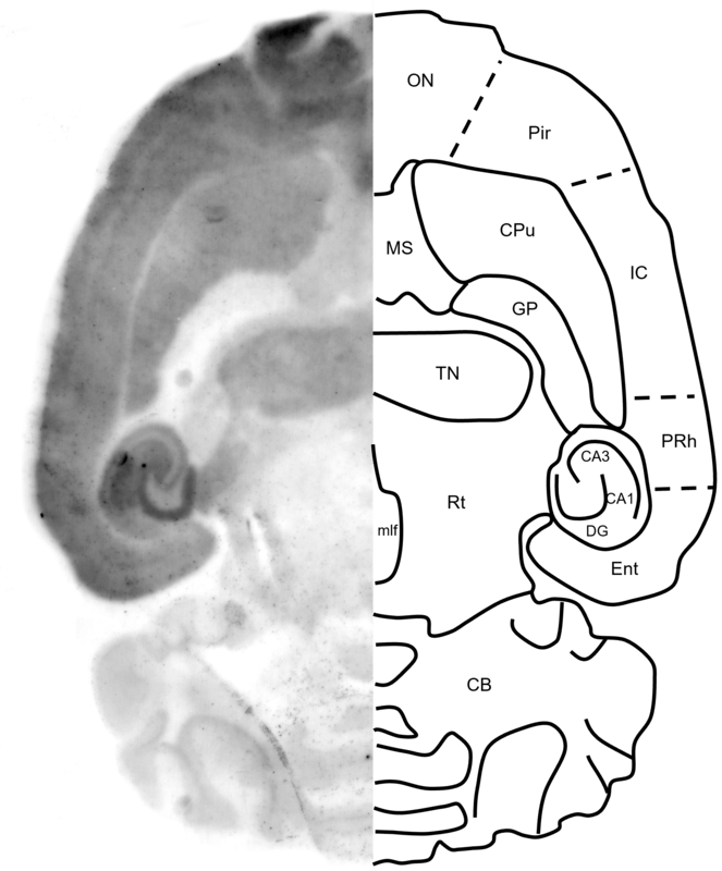 Figure 6. GluN1 histoblot in a horizontal rat brain section using HB7535.