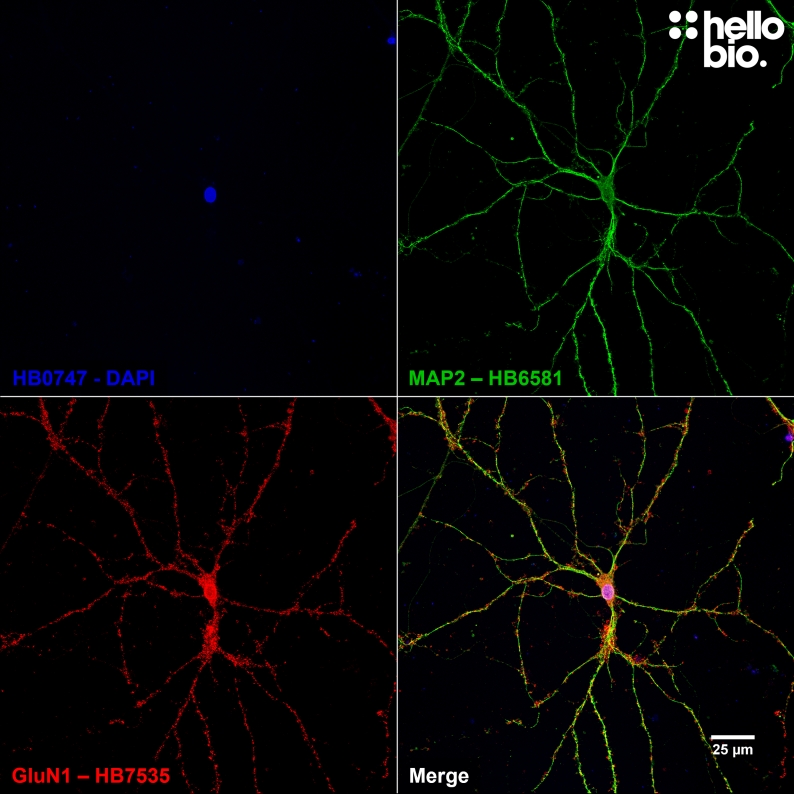 Figure 1. GluN1 expression in cultured cortical neurons visualized using HB7535.