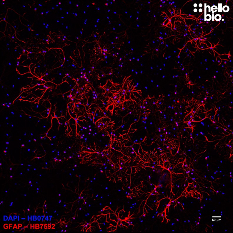 Figure 2. Astrocyte populations in culture stained by HB7592.