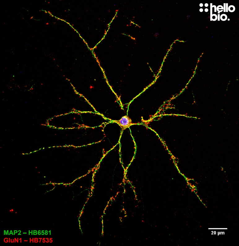 Figure 5. GluN1 expression on a cultured cortical rat neuron using HB6581 MAP2 labelling.