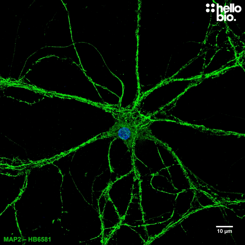 Figure 6. Cultured rat neuron labelled for MAP2 with HB6581