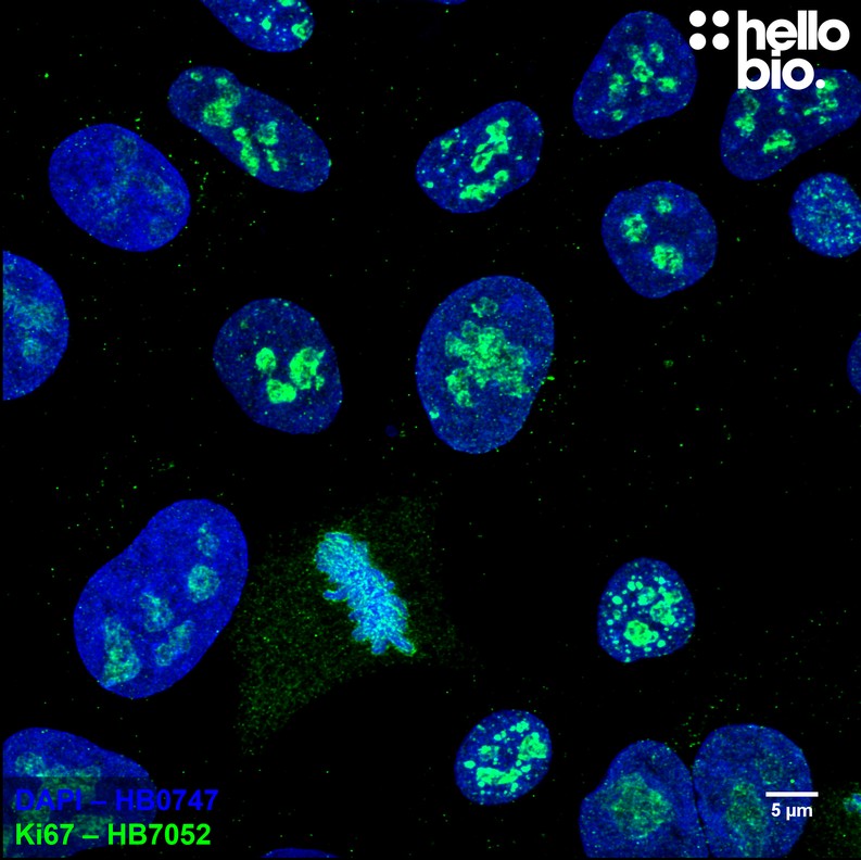 Figure 4. Ki-67 expression in proliferating HEK293T cells