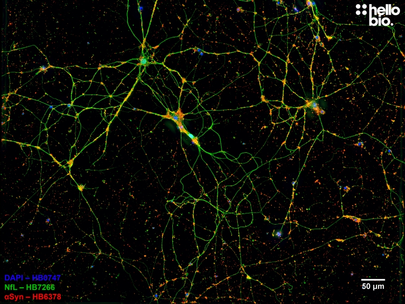 Figure 6. α-Synuclein staining in cultured rat cortical neurons.