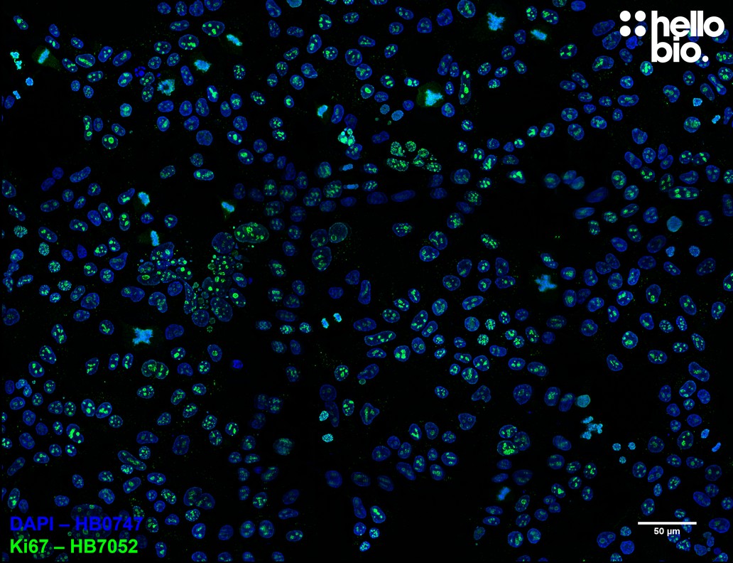 Figure 5. Large population of Ki-67 expressing HEK293T cells in culture stained with HB7052.
