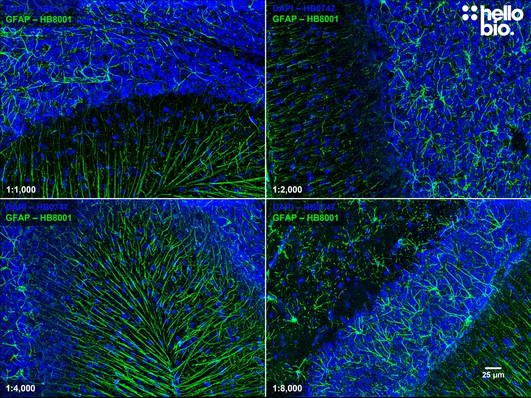 Figure 4. Concentration response of HB8001 staining in rat  cerebellum.