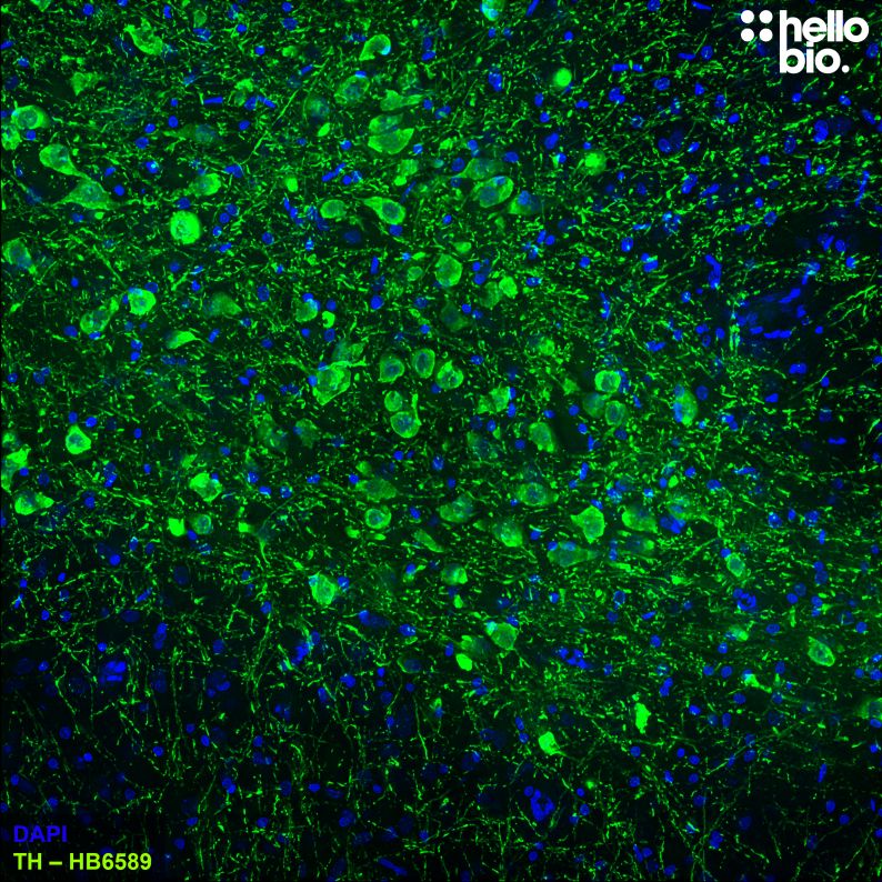 Figure 1. Tyrosine hydroxylase expressing dopaminergic midbrain neurons stained with HB7167.