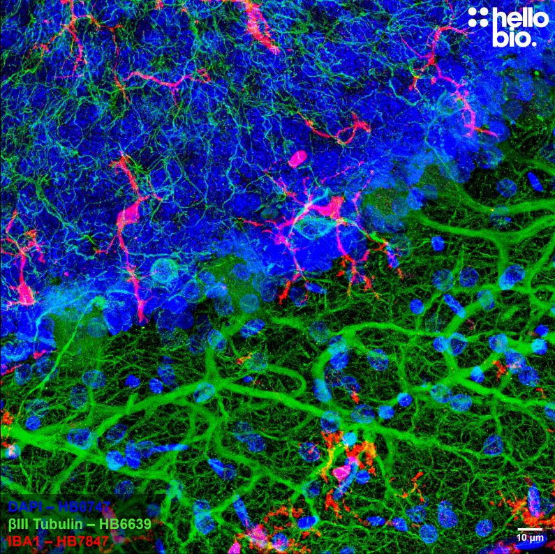 Figure 1. Cerebellar microglia stained for IBA1 with HB7847.