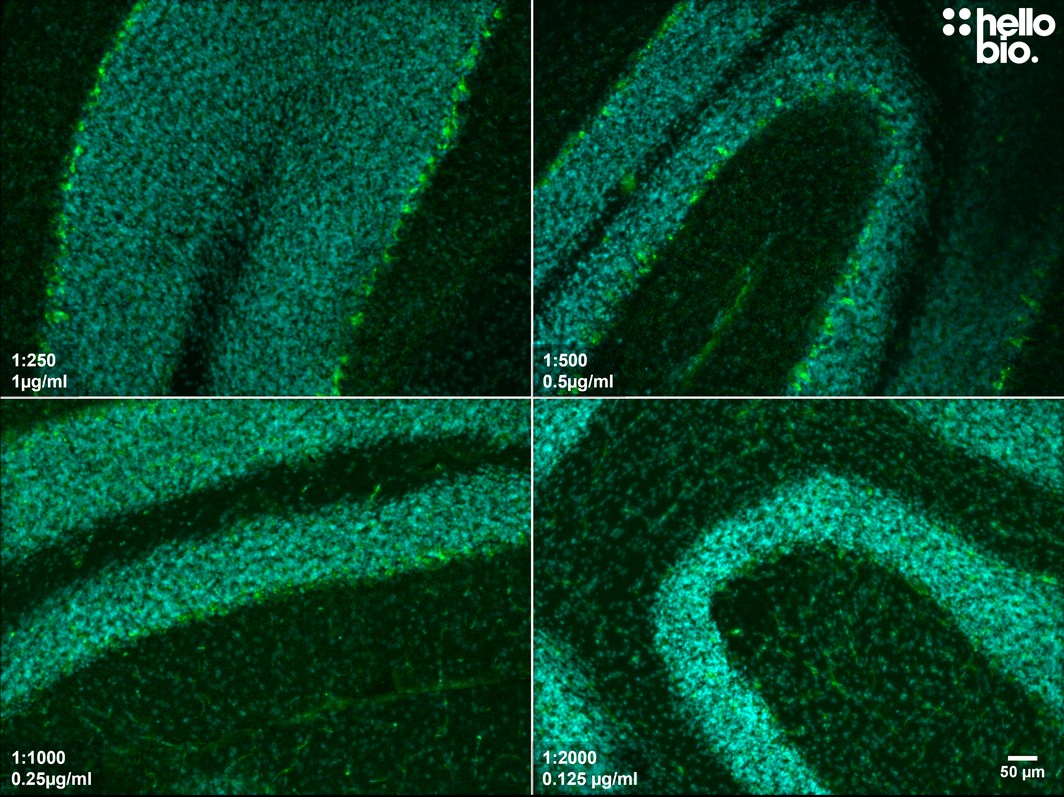 Figure 6. The effect of varying HB7632 concentration upon GAT1 staining in rat cerebellum. 