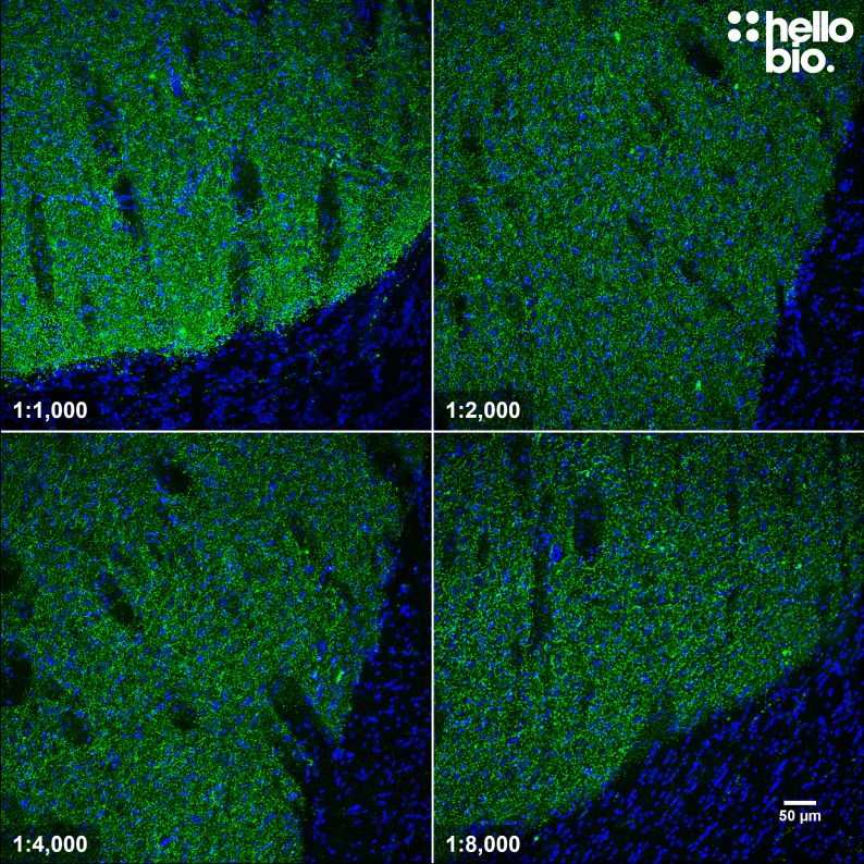 Figure 4. Concentration response of HB6589 staining in rat striatum.