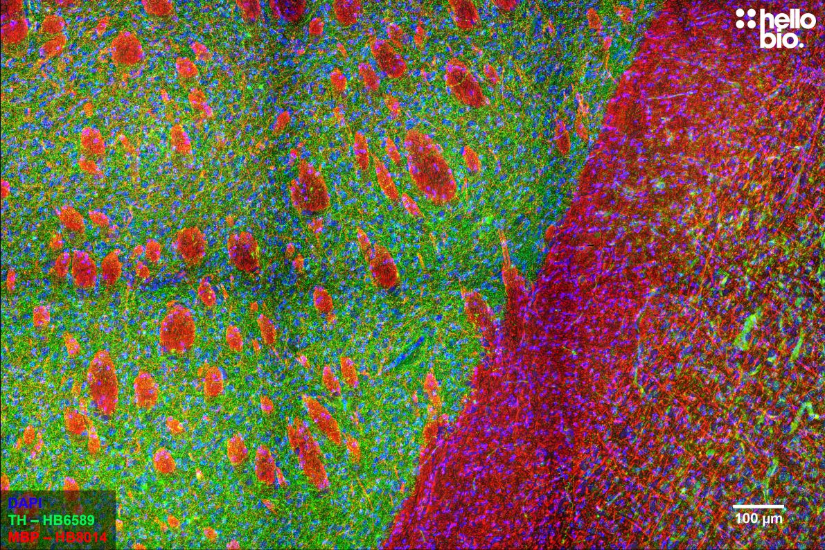 Figure 2. Rat striatum stained for tyrosine hydroxylase and myelin basic protein with HB6589 and HB8014.