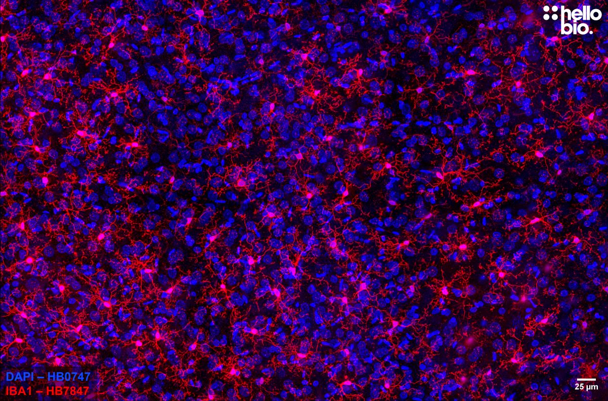 Figure 2. Cortical microglia stained for IBA1 with HB7847