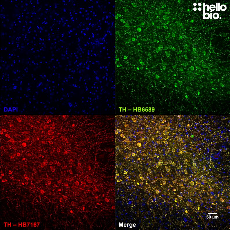 Figure 7.  Independent antibody validation of HB7167 and HB6589 in midbrain dopaminergic neurons.
