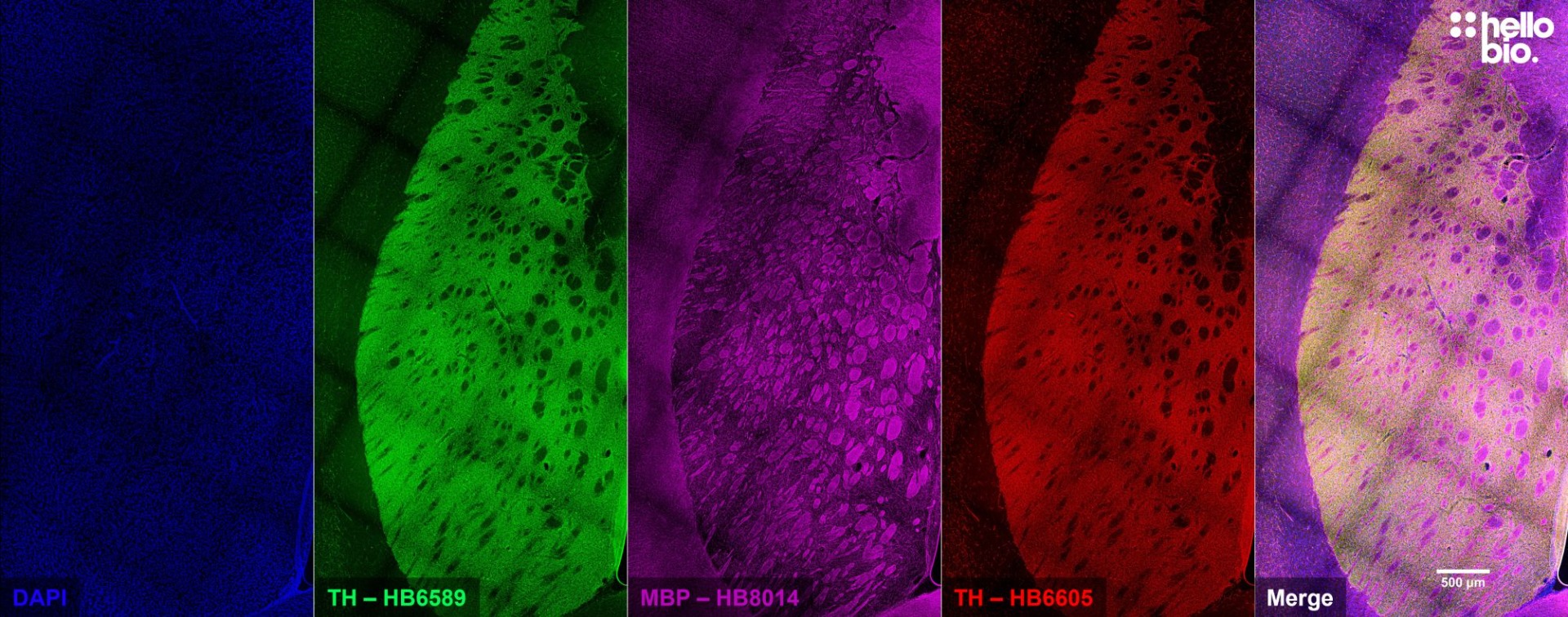 Figure 3. Independent antibody validation of HB6589 and HB6605 in rat CPu.