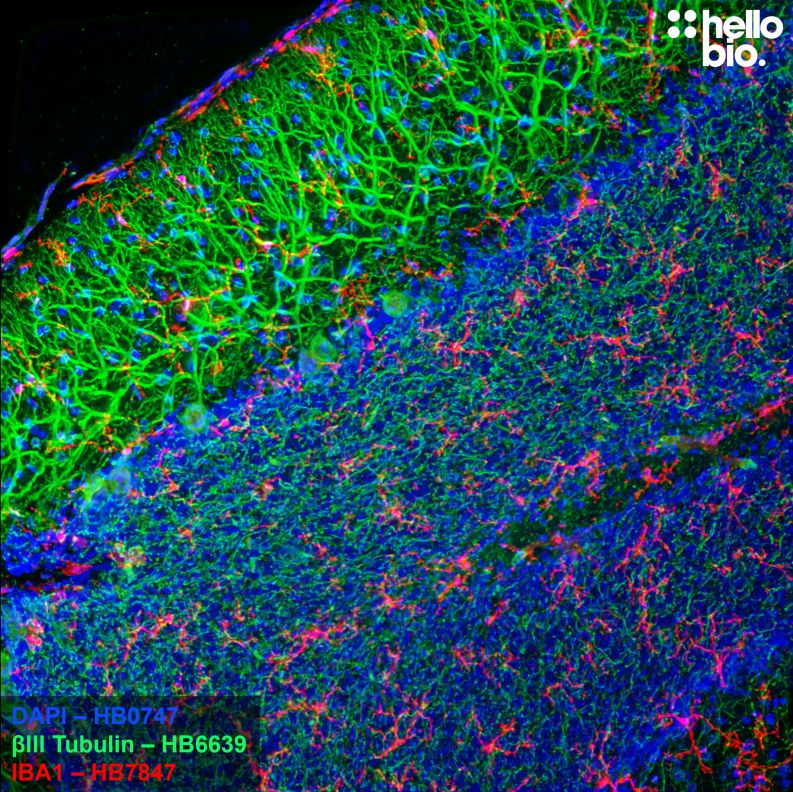 Figure 8. Microglia and Purkinje cells in the cerebellum