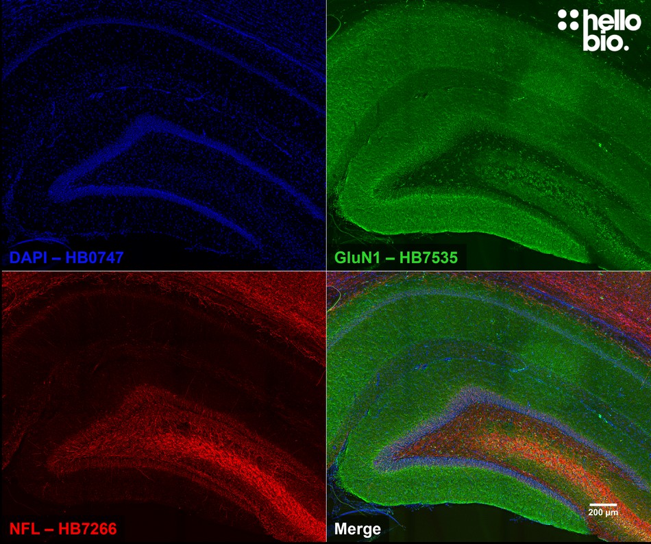 Figure 4. GluN1 expression in rat dentate gyrus mapped using HB7535.