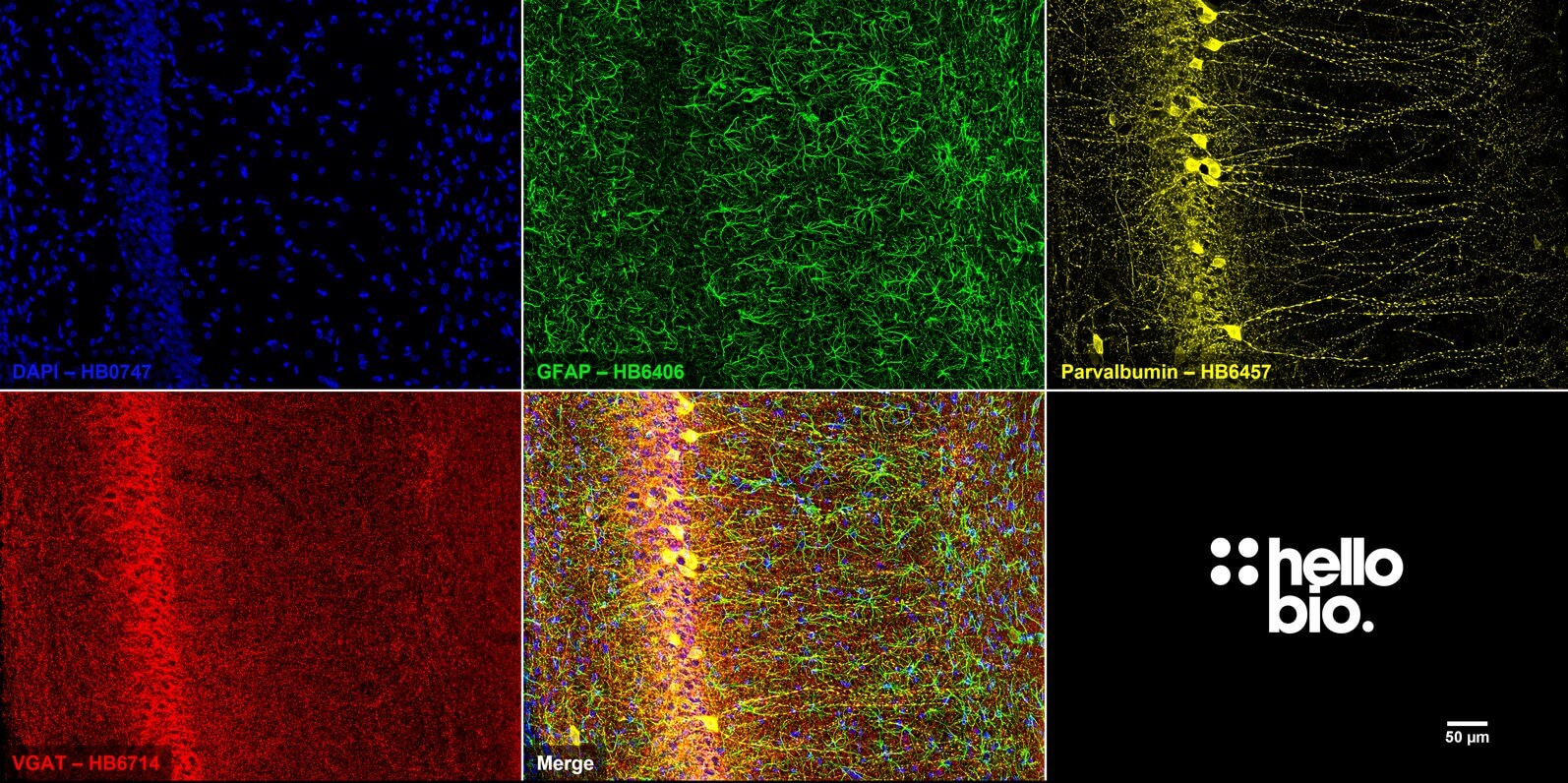 Figure 3. VGAT, Parvalbumin and GFAP expression in rat hippocampal CA1.