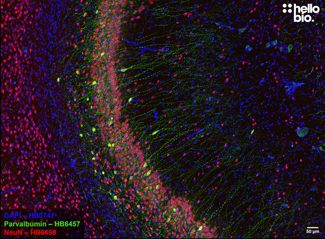 Figure 4. Parvalbumin expressing interneurons in hippocampal CA1.