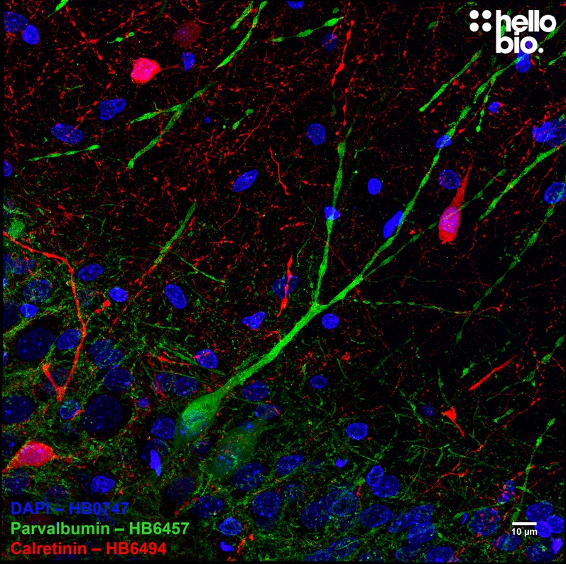 Figure 1. Parvalbumin and Calretinin expressing interneurons in hippocampal CA1.
