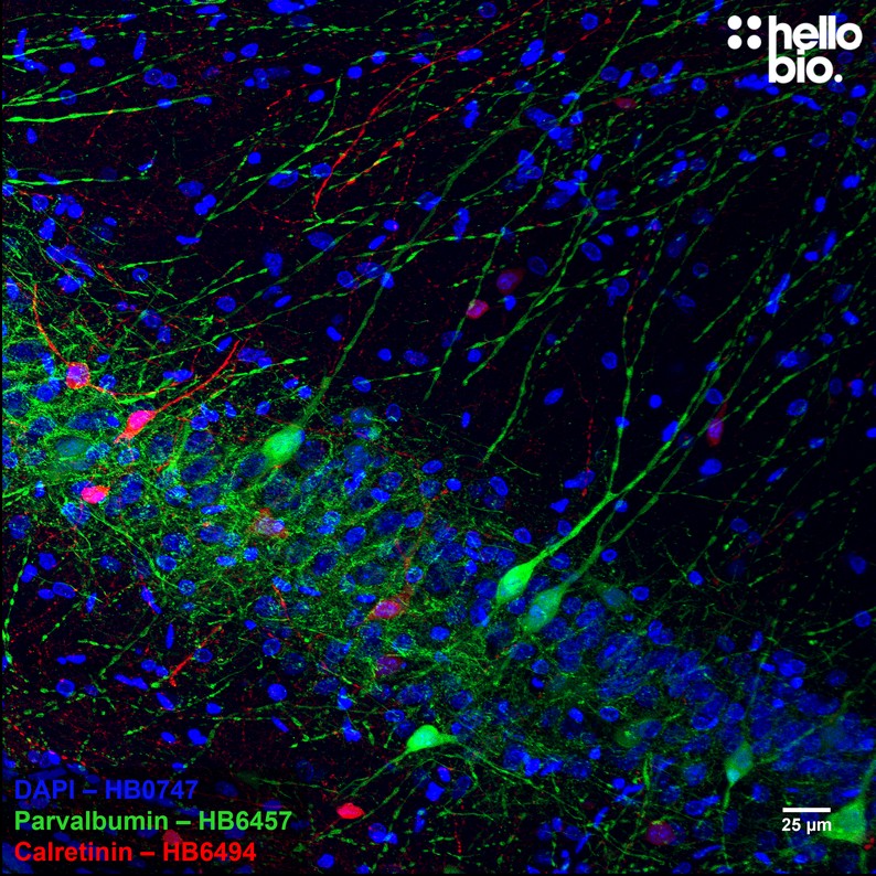 Figure 6. Parvalbumin and Calretinin expressing interneurons in hippocampal CA1.