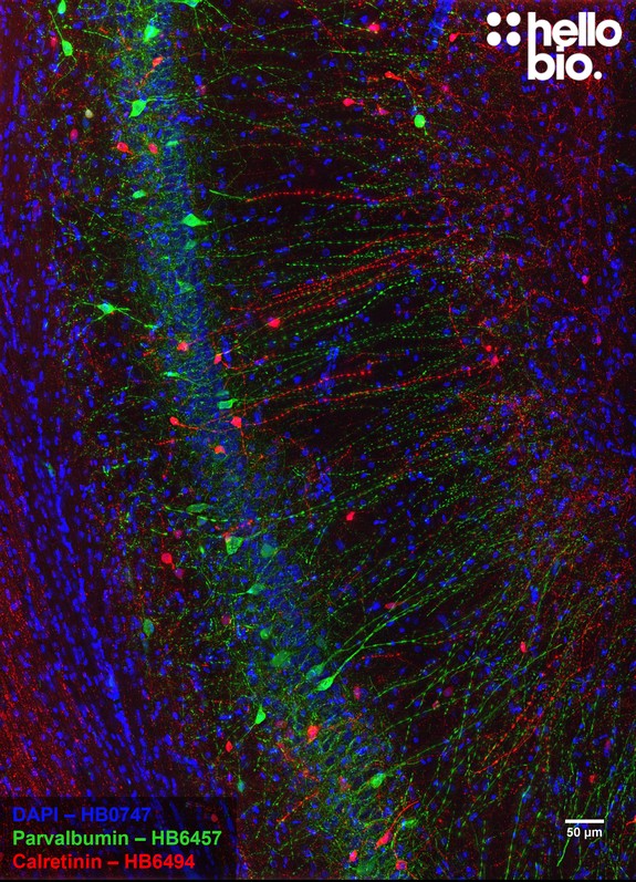 Figure 2. Parvalbumin and Calretinin expressing interneurons in hippocampal CA1.