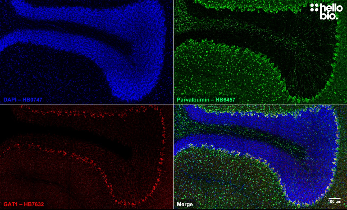 Figure 8. Parvalbumin and GAT1 expressing neurons in rat cerebellum.