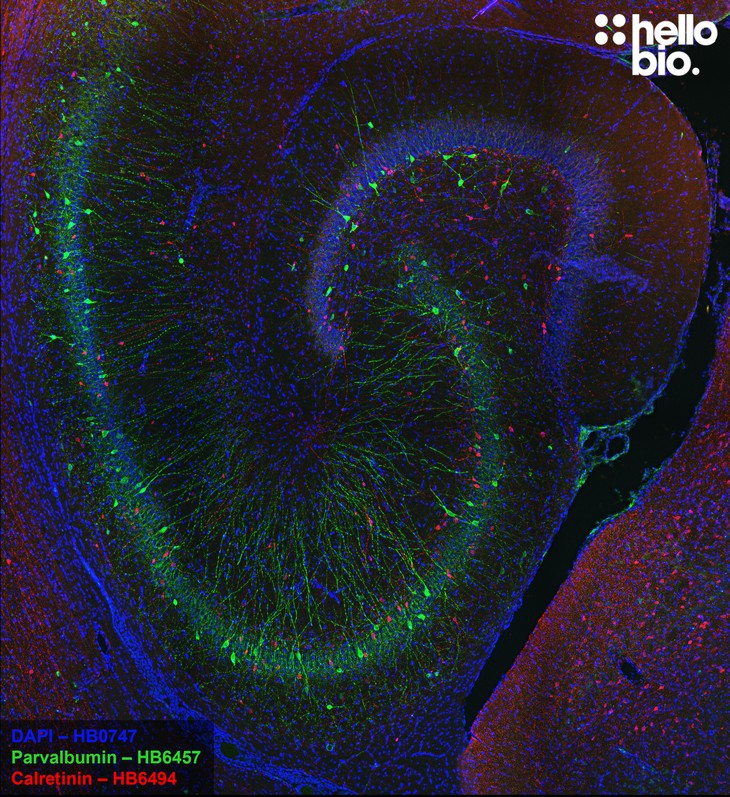 Figure 9. Parvalbumin and Calretinin expressing interneurons in the rat hippocampus
