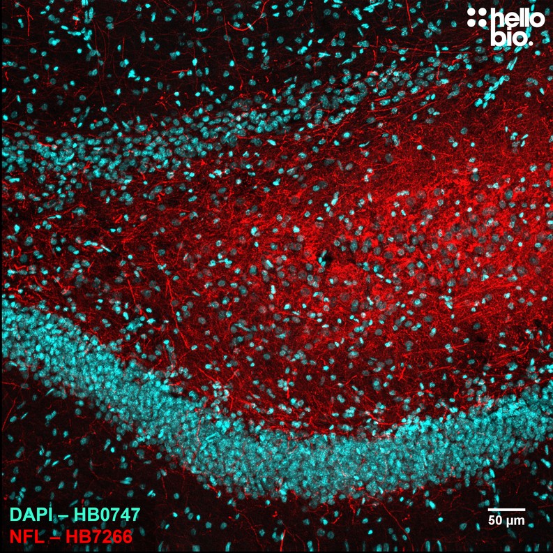 Figure 3. Neurofilament L expression in rat dorsal hippocampus visualised using HB7266. 