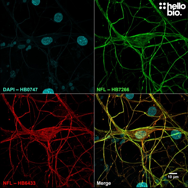 Figure 1. Independent antibody validation of HB7266 in cultured rat neurons. 