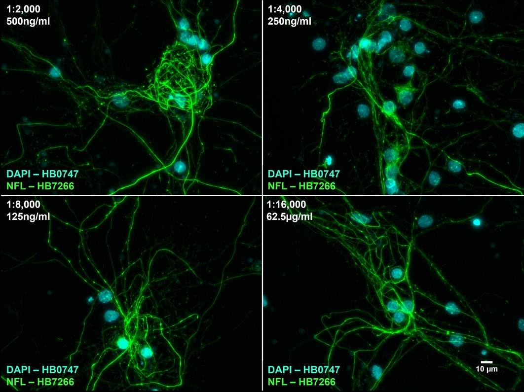 Figure 8. The effect of varying HB7266 concentration upon NFL staining in cultured rat neurones. 