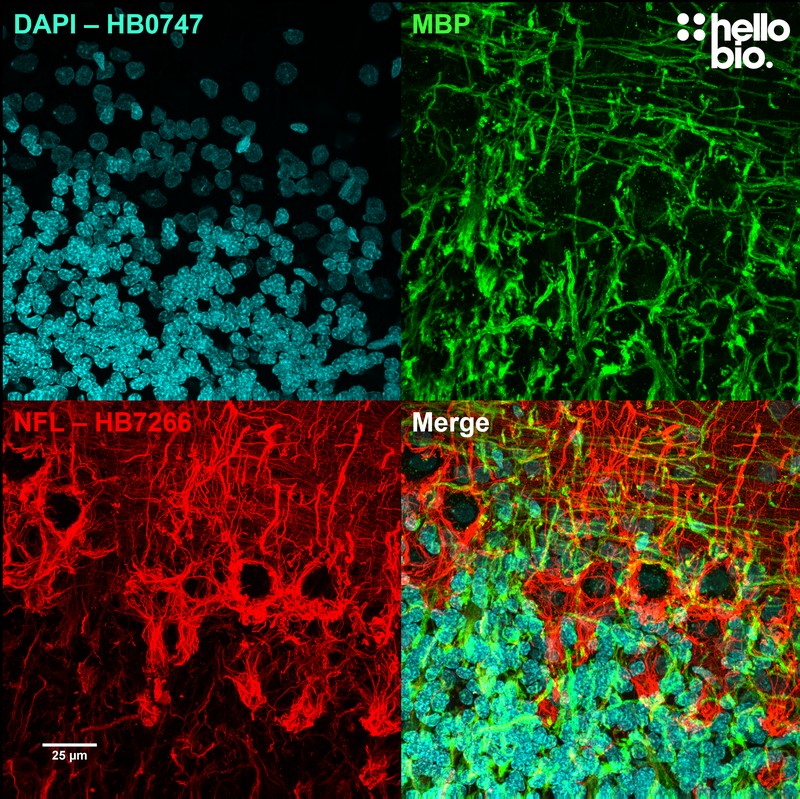 Figure 2. Neurofilament L and MBP staining in rat cerebellum visualised using HB7266.
