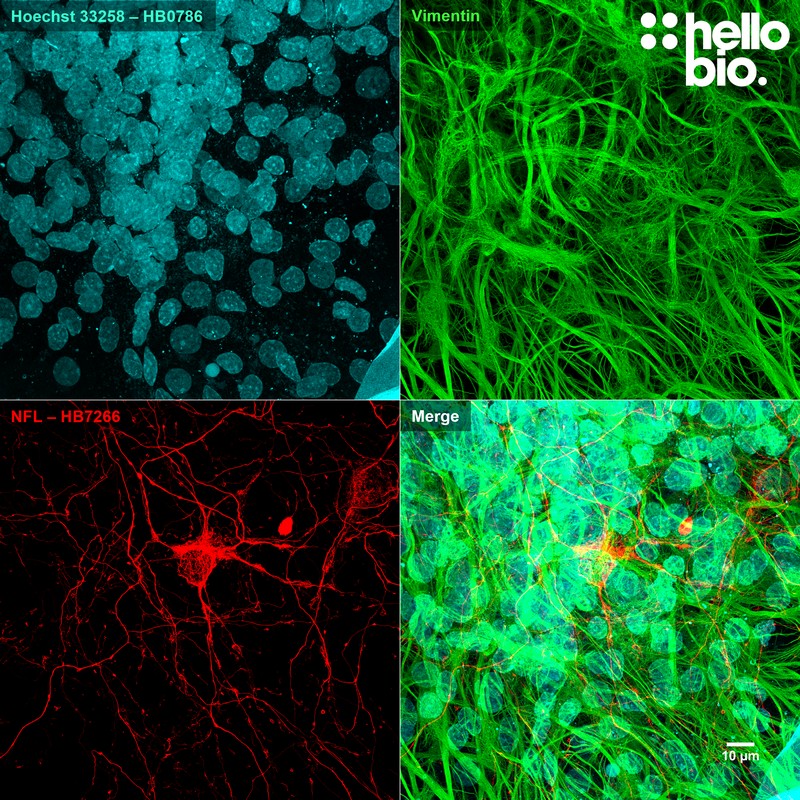 Figure 9. Neurofilament L (HB7266) and Vimentin staining in cultured rat neurones.