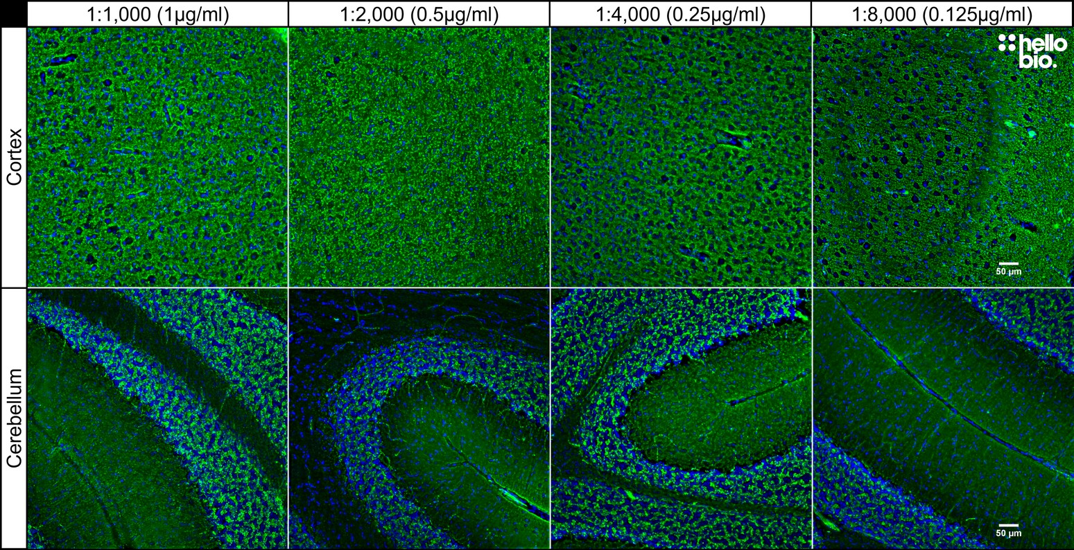Figure 7. Concentration response of HB6378 staining in rat cortex and cerebellum.