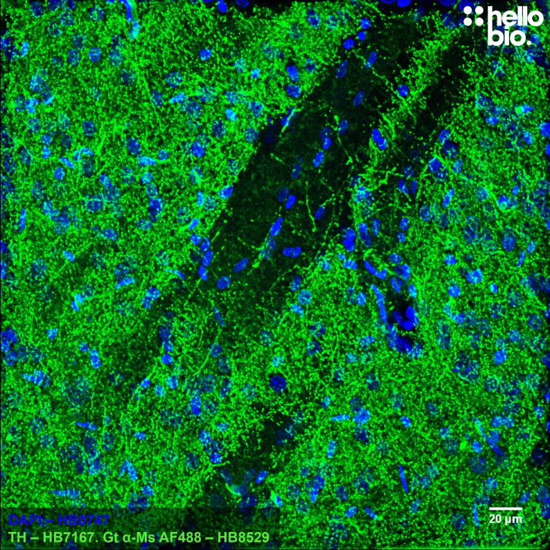 Figure 6. Tyrosine hydroxlase staining in rat caudate putamen using HB8529 Goat Anti-Mouse H&L (AF488) secondary antibody 