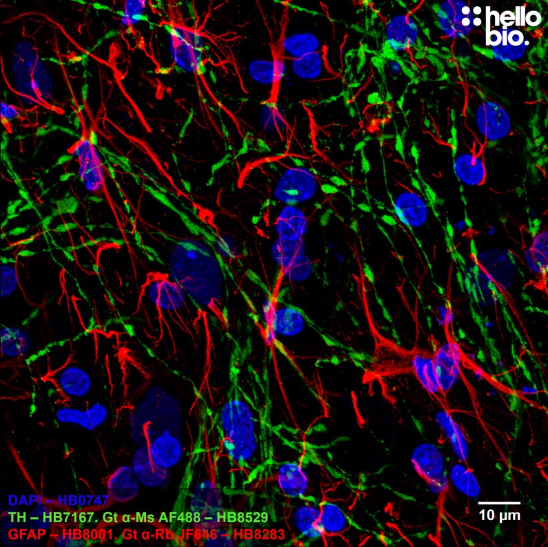 Figure 8. Tyrosine hydroxlase and GFAP staining in rat midbrain using HB8529 Goat Anti-Mouse H&L (AF488) and HB8283 Goat Anti-Rabbit H&L (Janelia Fluor® 646) 