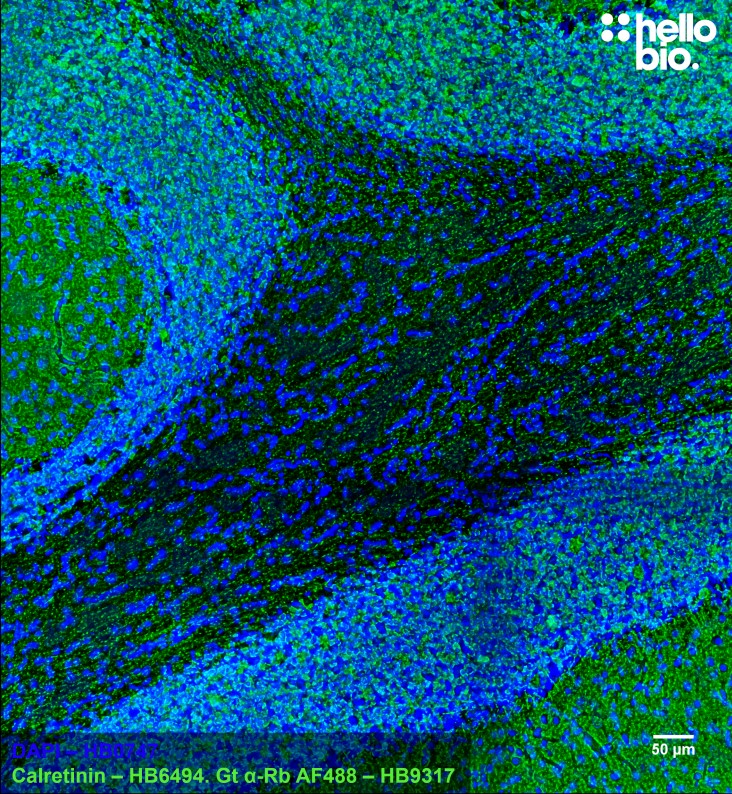 Figure 4. Calretinin staining in rat cerebellum using HB6494 and HB9317 Goat Anti-Rabbit H&L (AF488).