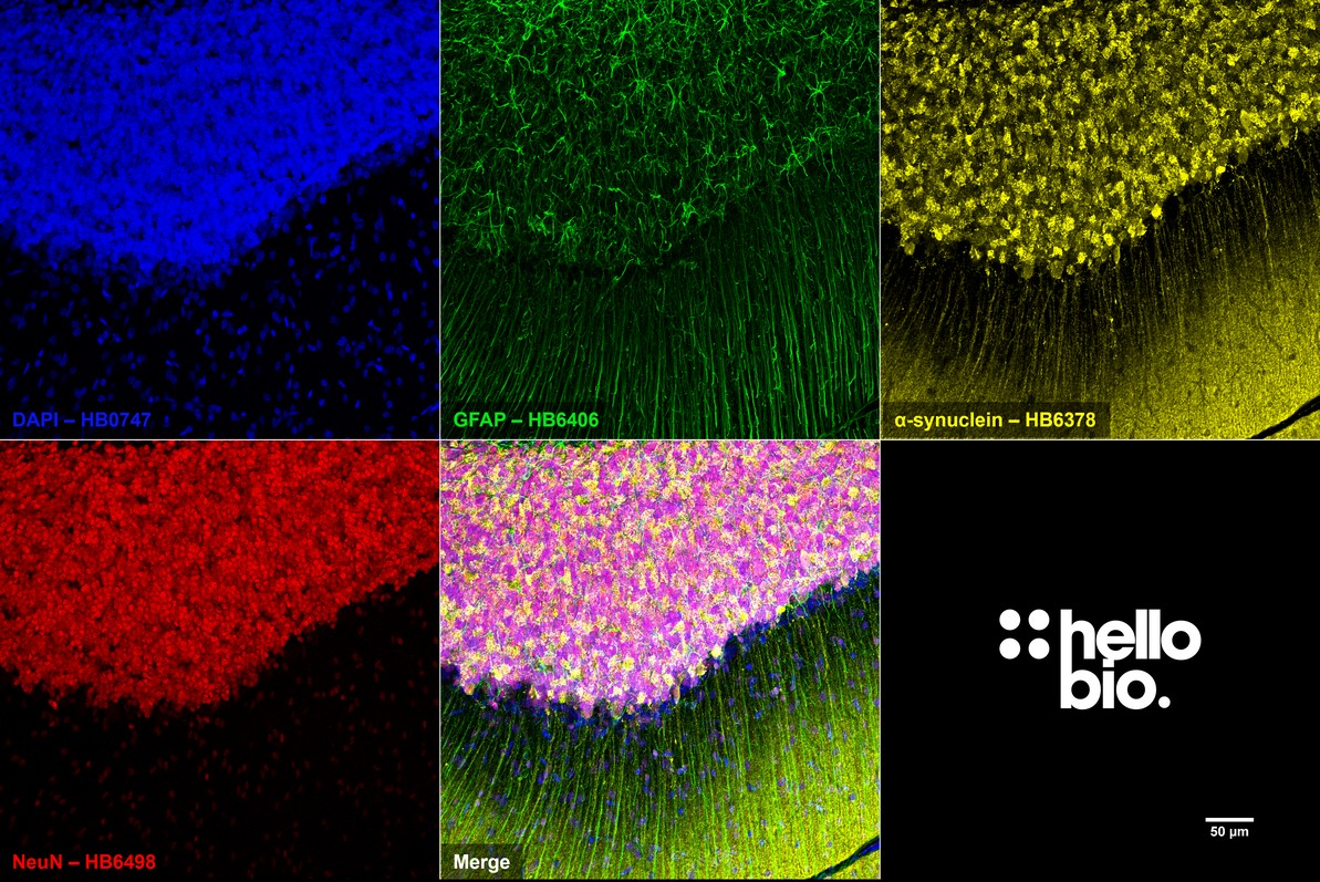 Figure 4. α-Synuclein, NeuN and GFAP staining in rat cerebellum