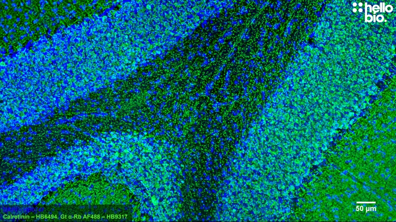 Figure 7. Calretinin staining in rat cerebellum using HB6494 and HB9317 Goat Anti-Rabbit H&L (AF488).