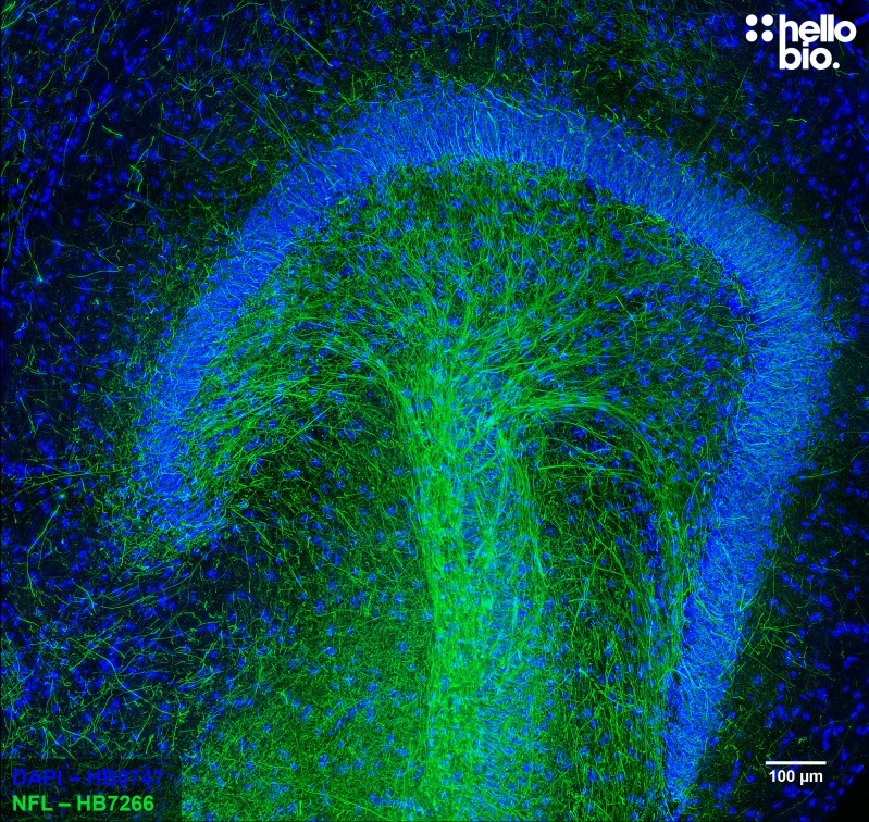 Figure 10. Neurofilament L staining in rat dentate gyrus. Mounted using MightyMount<sup>TM</sup> Antifade Fluorescence Mounting Medium (aqueous).