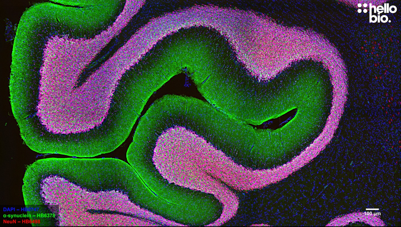 Figure 1. α-Synuclein staining in rat cerebellum localises to the molecular layer.