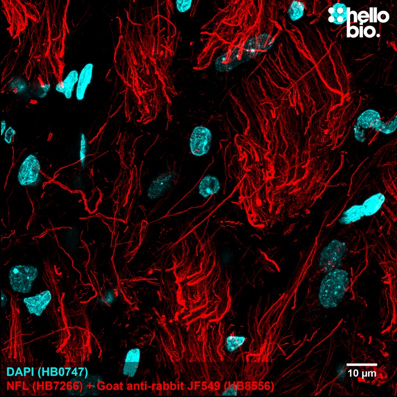 Figure 1. Neurofilament L staining in rat brain using HB8556 Goat Anti-Rabbit IgG H&L (Janelia Fluor® 549) preadsorbed secondary antibody.