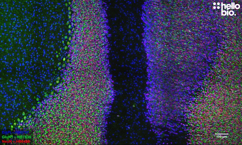Figure 5. GluN1 and NeuN staining in rat cerebellum. Mounted using MightyMount<sup>TM</sup> Antifade Fluorescence Mounting Medium (aqueous).