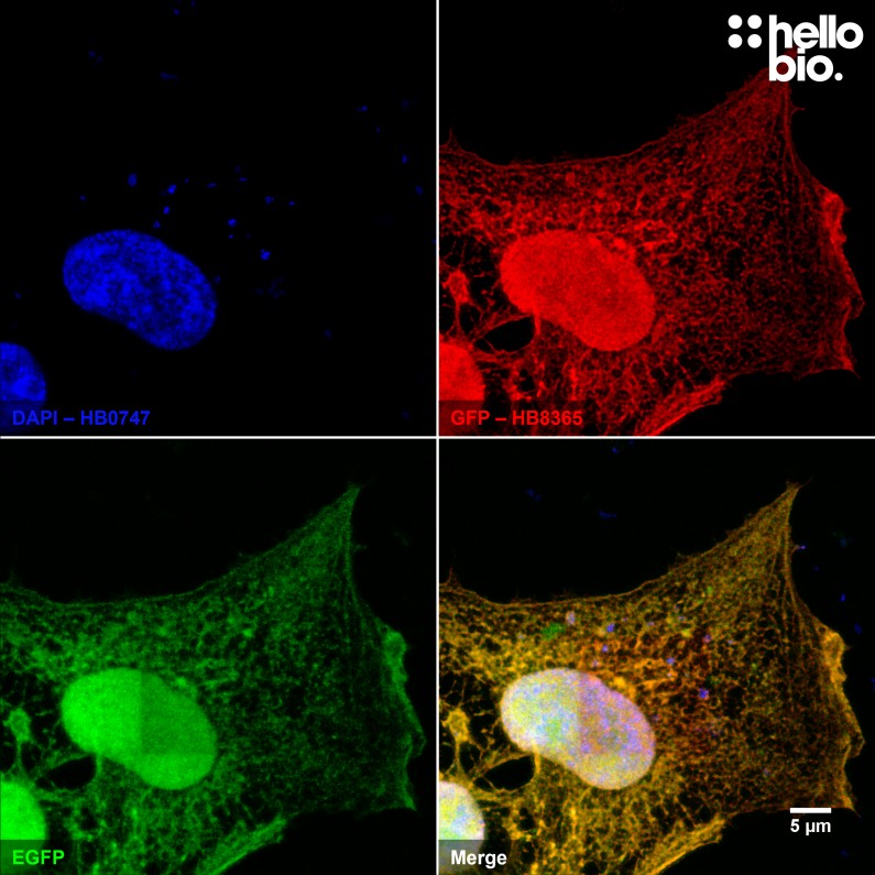 Figure 7. Confocal image of pEGFP-C2 transfected HEK293T showing bleaching of EGFP signal but not HB8365 derived signal.