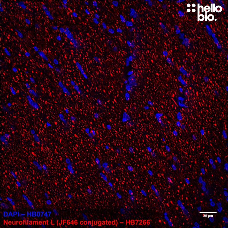 Figure 4. Janelia Fluor® 646 conjugated anti-neurofilament light antibody staining in rat brainstem