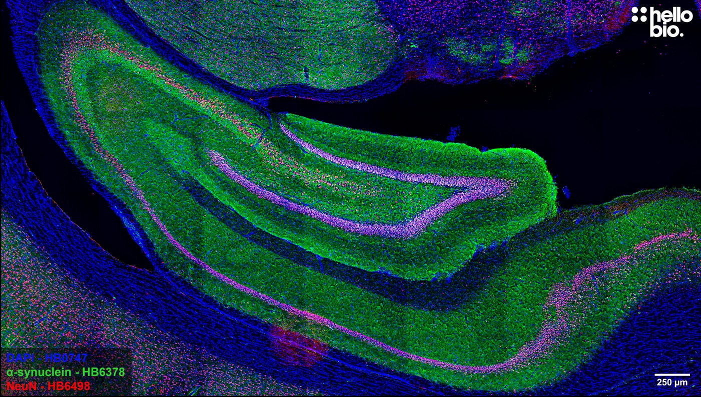 Figure 2. α-Synuclein staining in rat hippocampus.