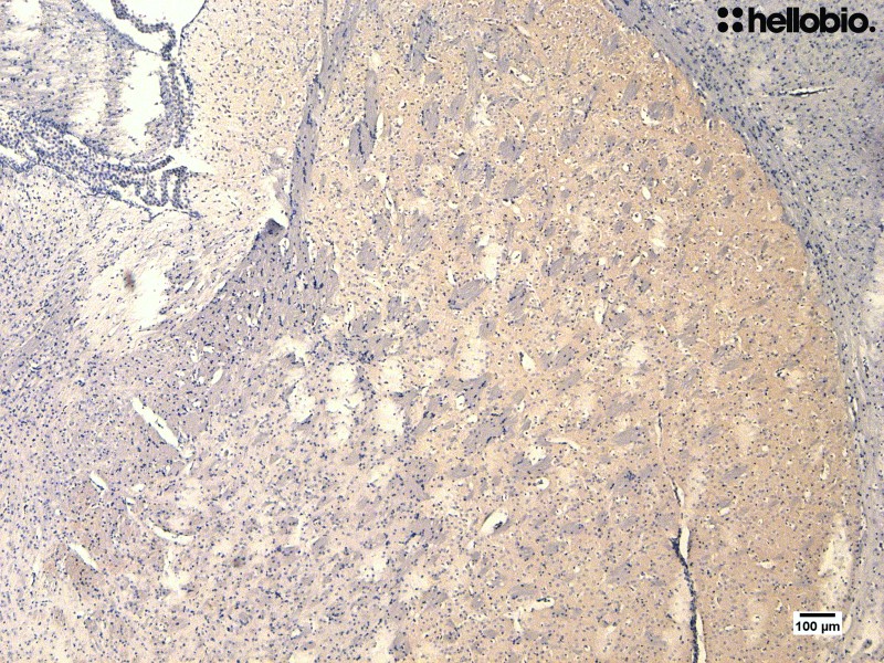 Figure 6. Tyrosine hydroxylase staining in mouse striatum with hematoxylin counterstain