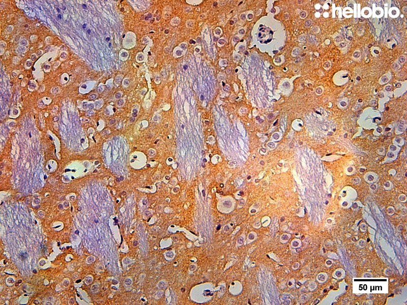 Figure 4. Tyrosine hydroxylase staining in rat striatum visualized using biotin-streptavidin detection.