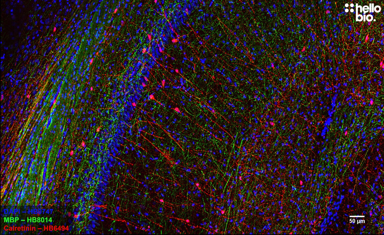Figure 2. MBP and Calretinin staining in rat hippocampus. Mounted using MightyMount<sup>TM</sup> Antifade Fluorescence Mounting Medium (hardset).